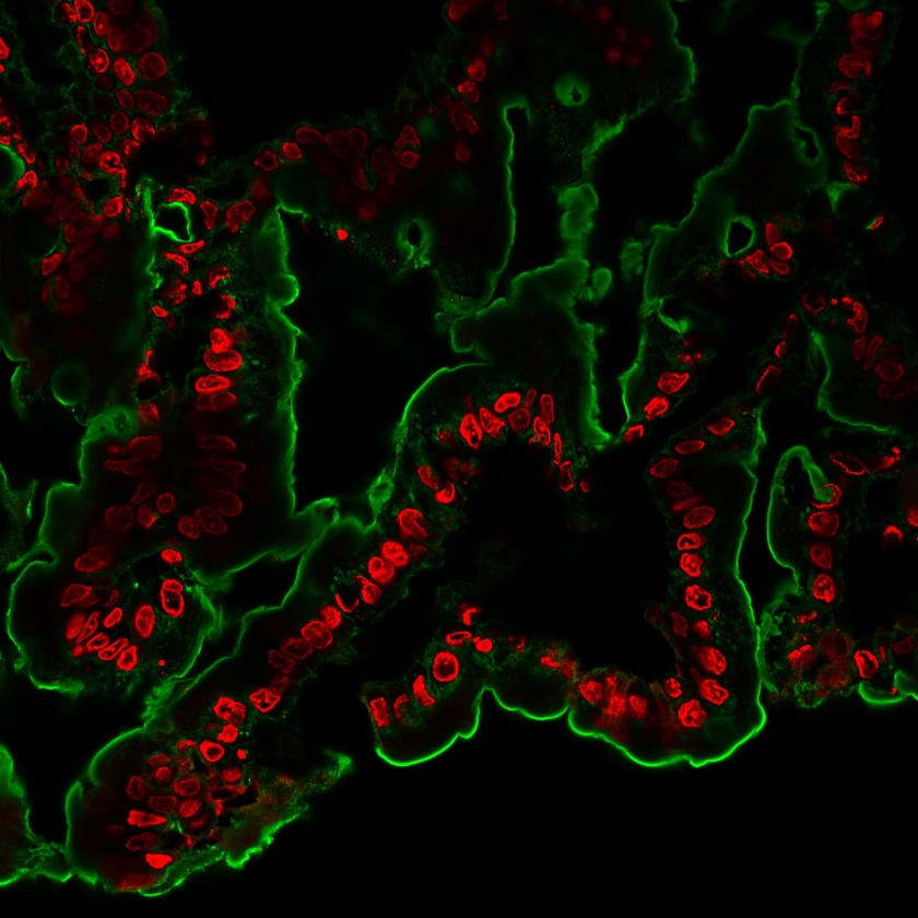Wheat Germ Agglutinin (WGA) Conjugates - Image 6
