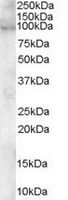 TA302969 staining (0.1ug/ml) of human heart lysate (RIPA buffer, 30ug total protein per lane). Primary incubated for 1 hour. Detected by western blot using chemiluminescence.