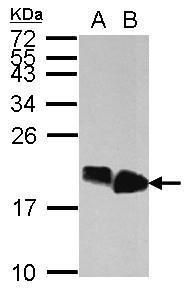 Sample (30 ug of whole cell lysate). A: HepG2. B: HCT116. 15% SDS PAGE. TA308757 diluted at 1:10000.