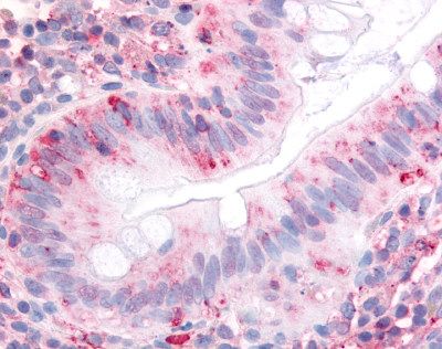 Anti-ITGA2 / CD49b antibody IHC of human colon, surface epithelium. Immunohistochemistry of formalin-fixed, paraffin-embedded tissue after heat-induced antigen retrieval.