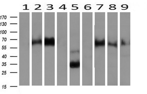 Western blot analysis of extracts (10ug) from 9 Human tissue by using anti-NPTN monoclonal antibody at 1:200 (1: Testis; 2: Omentum; 3: Uterus; 4: Breast; 5: Brain; 6: Liver; 7: Ovary; 8: Thyroid gland; 9: Colon).