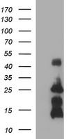 HEK293T cells were transfected with the pCMV6-ENTRY control (Cat# <a href = "https://www.origene.com/catalog/vectors/mammalian-expression-vectors/ps100001-pcmv6-entry-mammalian-expression-vector" title="PS100001" class="">PS100001</a>, Left lane) or pCMV6-ENTRY TNF (Cat# <a href = "https://www.origene.com/catalog/cdna-clones/expression-plasmids/rc206983-tnf-alpha-tnf-nm-000594-human-tagged-orf-clone" title="RC206983" class="">RC206983</a>, Right lane) cDNA for 48 hrs and lysed. Equivalent amounts of cell lysates (5 ug per lane) were separated by SDS-PAGE and immunoblotted with anti-TNF (Cat# TA506513). Positive lysates <a href = "https://www.origene.com/catalog/proteins/over-expression-lysates/ly424626-tnf-alpha-tnf-nm-000594-human-over-expression-lysate" title="LY424626" class="">LY424626</a> (100ug) and <a href = "https://www.origene.com/catalog/proteins/over-expression-lysates/lc424626-tnf-alpha-tnf-nm-000594-human-over-expression-lysate" title="LC424626" class="">LC424626</a> (20ug) can be purchased separately from OriGene.
