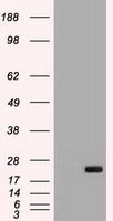 HEK293T cells were transfected with the pCMV6-ENTRY control (Left lane) or pCMV6-ENTRY IL-6 (<a href = "https://www.origene.com/catalog/cdna-clones/expression-plasmids/rc202078-il6-nm-000600-human-tagged-orf-clone" title="RC202078" class="">RC202078</a>, Right lane) cDNA for 48 hrs and lysed. Equivalent amounts of cell lysates (5 ug per lane) were separated by SDS-PAGE and immunoblotted with anti-IL-6. Positive lysates <a href = "https://www.origene.com/catalog/proteins/over-expression-lysates/ly424617-il6-nm-000600-human-over-expression-lysate" title="LY424617" class="">LY424617</a> (100ug) and <a href = "https://www.origene.com/catalog/proteins/over-expression-lysates/lc424617-il6-nm-000600-human-over-expression-lysate" title="LC424617" class="">LC424617</a> (20ug) can be purchased separately from OriGene.