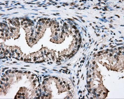 Immunohistochemical staining of paraffin-embedded Human prostate tissue within the normal limits using anti-PTPRE mouse monoclonal antibody. (TA501051; heat-induced epitope retrieval by 1mM EDTA in 10mM Tris, pH8.5, 120°C for 3min). Heat-induced epitope retrieval by EDTA solution buffer pH 8.0 at 120°C for 3 min.