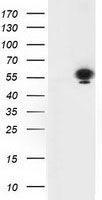 HEK293T cells were transfected with the pCMV6-ENTRY control (Cat# <a href = "https://www.origene.com/catalog/vectors/mammalian-expression-vectors/ps100001-pcmv6-entry-mammalian-expression-vector" title="PS100001" class="">PS100001</a>, Left lane) or pCMV6-ENTRY TP53 (Cat# <a href = "https://www.origene.com/catalog/cdna-clones/expression-plasmids/rc200003-p53-tp53-nm-000546-human-tagged-orf-clone" title="RC200003" class="">RC200003</a>, Right lane) cDNA for 48 hrs and lysed. Equivalent amounts of cell lysates (5 ug per lane) were separated by SDS-PAGE and immunoblotted with anti-TP53 (Cat# TA502870). Positive lysates <a href = "https://www.origene.com/catalog/proteins/over-expression-lysates/ly400186-p53-tp53-nm-000546-human-over-expression-lysate" title="LY400186" class="">LY400186</a> (100ug) and <a href = "https://www.origene.com/catalog/proteins/over-expression-lysates/lc400186-p53-tp53-nm-000546-human-over-expression-lysate" title="LC400186" class="">LC400186</a> (20ug) can be purchased separately from OriGene.