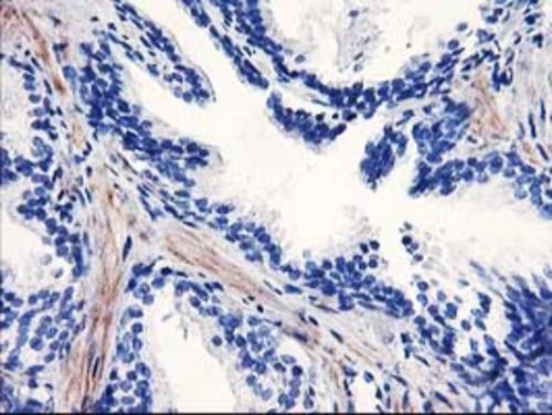 Immunohistochemical staining of paraffin-embedded Human prostate tissue within the normal limits using anti-PPARA mouse monoclonal antibody. Heat-induced epitope retrieval by EDTA solution buffer pH 8.0 at 120°C for 3 min.