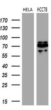 Western blot analysis of extracts (35ug) from 2 different cell lines by using anti-ROS1 monoclonal antibody (1:500).