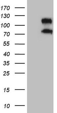 HEK293T cells were transfected with the pCMV6-ENTRY control (Cat# <a href = "https://www.origene.com/catalog/vectors/mammalian-expression-vectors/ps100001-pcmv6-entry-mammalian-expression-vector" title="PS100001" class="">PS100001</a>, Left lane) or pCMV6-ENTRY CD34 (Cat# <a href = "https://www.origene.com/catalog/cdna-clones/expression-plasmids/rc204446-cd34-nm-001025109-human-tagged-orf-clone" title="RC204446" class="">RC204446</a>, Right lane) cDNA for 48 hrs and lysed. Equivalent amounts of cell lysates (5 ug per lane) were separated by SDS-PAGE and immunoblotted with anti-CD34 (Cat# TA808885)(1:2000). Positive lysates <a href = "https://www.origene.com/catalog/proteins/over-expression-lysates/ly422593-cd34-nm-001025109-human-over-expression-lysate" title="LY422593" class="">LY422593</a> (100ug) and <a href = "https://www.origene.com/catalog/proteins/over-expression-lysates/lc422593-cd34-nm-001025109-human-over-expression-lysate" title="LC422593" class="">LC422593</a> (20ug) can be purchased separately from OriGene.