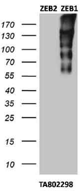 Cross-reactivity test with ZEB2: HEK293T cells were transfected with plasmids overexpressing either ZEB2 (left) or ZEB1 (right) and immunoblotted with anti-ZEB1 (TA802298).