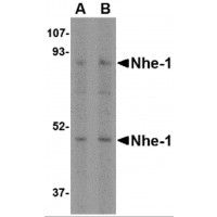 Western blot analysis of Nhe-1 in rat kidney tissue lysate with in with Nhe-1 antibody at (A) 1 and (B) 2ug/ml.