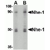 Western blot analysis of Nhe-1 in MOLT4 cell lysate with in with Nhe-1 antibody at (A) 1 and (B) 2ug/ml.