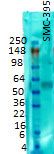 Western blot analysis of VGlut2 on rat membrane tissues using a 1:1000 dilution of the antibody