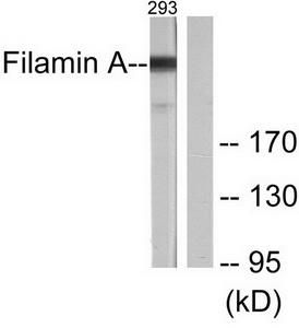 Western blot analysis of extracts from 293 cells treated with EGF (200ng/ml, 5mins), using Filamin A (Ab-2152) antibody (#TA313882, Line 1 and 2).The lane on the right is treated with the synthesized peptide.