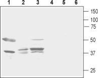 Western blot analysis of rat brain lysate (lanes 1 and 4), rat stomach lysate (lanes 2 and 5) and mouse kidney lysate (lanes 3 and 6): 1-3. Anti-Prostanoid EP2 Receptor (extracellular) antibody, (1:500). 4-6. Anti-Prostanoid EP2 Receptor (extracellular) antibody, preincubated with the control peptide antigen.