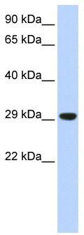 WB Suggested Anti-Tfam Antibody Titration: 0.2-1 ug/ml; ELISA Titer: 1:312500; Positive Control: Mouse Muscle