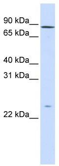 GPSM2 antibody - N-terminal region validated by WB using Fetal Liver Lysate at 1 ug/ml.