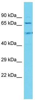 Host: Rabbit; Target Name: DTX4; Sample Tissue: Fetal Liver lysates; Antibody Dilution: 1.0ug/ml