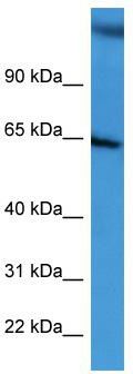 WB Suggested Anti-BCAM Antibody Titration: 0.2-1 ug/ml; ELISA Titer: 1:312500; Positive Control: HepG2 cell lysate BCAM is strongly supported by BioGPS gene expression data to be expressed in Human HepG2 cells