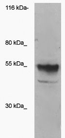 WB: The whole cell lysate derived from HEK293 over-expressed ST6Gal protein was loaded in SDSPAGE, transferred onto a NC membrane, then blotted by Rabbit anti-ST6Gal antibody at 1:500. An immune reactive band is observed around ~52kD. (The biotinylated antibody was confirmed by HRPStrepavidin)