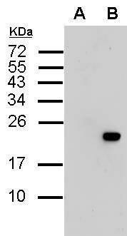 Western blot analysis of extracts from untransfected control cells and transfected cells overexpressing His-tagged protein (~19 kDa), using His-tag antibody. A: 10ug E.coli Lysate harbouring His-tagged recombinant protein (N-terminal linked), non-induced (10 ug). B: 10ug E.coli Lysate harbouring His-tagged recombinant protein (N-terminal linked), induced (10 ug).