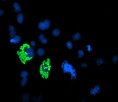 Immunofluorescent staining of COS7 cells transiently transfected with Myc-DDK tagged MYD88 (Cat# <a href = "https://www.origene.com/catalog/cdna-clones/expression-plasmids/rc202253-myd88-nm-002468-human-tagged-orf-clone" title="RC202253" class="">RC202253</a>).