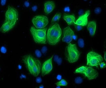 Immunofluorescent staining of COS7 cells transiently transfected with Myc-DDK tagged RASSF1 (Cat# <a href = "https://www.origene.com/catalog/cdna-clones/expression-plasmids/rc213525-rassf1-nm-007182-human-tagged-orf-clone" title="RC213525" class="">RC213525</a>).