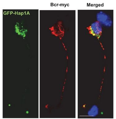 Figure from citation: Immunofluorescence of Myc-fused protein level by using anti-Myc antibody in differentiated neuro-2a cells transfected with Bcr-myc (red). Scale bar, 10 um. <a href="http://www.ncbi.nlm.nih.gov/pubmed/25671650" target="_blank">View Citation</a>