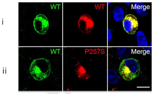 Figure from citation: Immunofluorescence of coexpressed wild-type (WT) HCN4 and p.Pro257Ser constructs tagged with unique C-terminal Myc tag by using anti-Myc antibody in Chinese hamster ovary cells. <a href="http://www.ncbi.nlm.nih.gov/pubmed/24607718" target="_blank">View Citation</a>