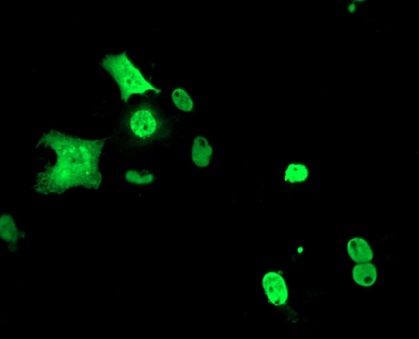 Immunofluorescent staining of COS7 cells transiently transfected with Myc-DDK tagged MEF2C (Cat# <a href = "https://www.origene.com/catalog/cdna-clones/expression-plasmids/rc220584-mef2c-nm-002397-human-tagged-orf-clone" title="RC220584" class="">RC220584</a>).