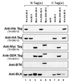 Western blot analysis of HEK293 cell lysates expressing BLK or BTK tagged by indicated epitopes.