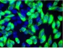 Hela cells transiently transfected with Myc/DDK tagged GFAP ORF cDNA clone were immunostained with 4C5 anti-DDK antibody (TA50011, 1:1000), and then colored in green with Alexa 488 conjugated secondary antibody (1:2000). The nuclei (blue) were counterstained with DAPI.