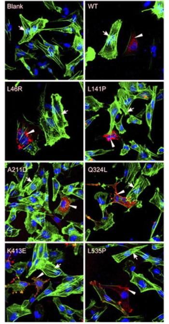 Immunofluorescence staining for F-actin (green) and merlin mutants (red) in CH157 NM cells transfected with wild-type merlin, merlin mutants, as well as empty vector (blank). The nuclei of cells were counterstained with Hoechst (blue). Arrows point to F-actin stress fibers and arrowheads point to mutant merlin.to right) and negative control vector (lane 1) using anti-HA tag rabbit monoclonal antibody (<a href = "https://www.origene.com/catalog/antibodies/tag-antibodies/ta591010-rabbit-monoclonal-anti-ha-tag-antibody-clone-otir5b11" title="TA591010" class="">TA591010</a>) at 1:2000 dilution. (https://doi.org/10.1073/pnas.1102198108)