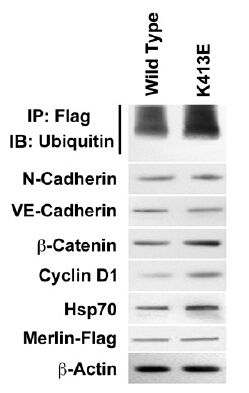 Figure from citation: Immunoprecipitation of DDK (FLAG) fused protein level by using anti-DDK antibody in human CH157 NM cells. Dilution: 1:200 <a href="http://www.ncbi.nlm.nih.gov/pubmed/21383154" target="_blank">View Citation</a>