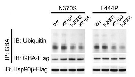 Figure from citation: Immunoprecipitation of DDK (FLAG) fused protein level by using anti-DDK antibody in HeLa cells. <a href="http://www.ncbi.nlm.nih.gov/pubmed/23277556" target="_blank">View Citation</a>