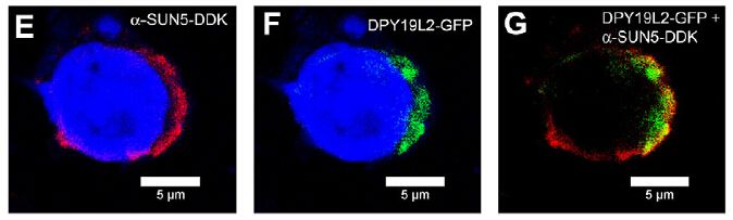Figure from citation: Immunofluorescence of DDK (FLAG) fused protein level by using anti-DDK antibody in HEK cells. <a href="http://dev.biologists.org/cgi/reprint/139/16/2955" target="_blank">View Citation</a>
