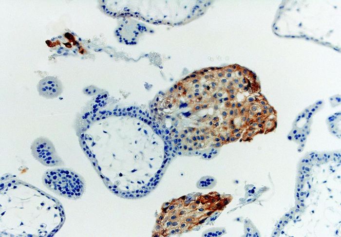 Immunohistochemistry staining with anti-human HLA-G (MEM-G/1) of first trimester placenta (paraffin-embedded sections).