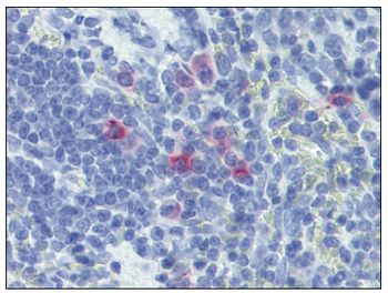 Formalin-Fixed, Paraffin-Embedded Rat Spleen stained with Interleukin-13 / IL13 Antibody at 10 ug/ml after heat-induced antigen retrieval.