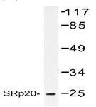 Western blot analysis of SRp20 (SFRS3) in extracts from HeLa using SFRS3 antibody.