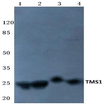 Western blot analysis of ASC Antibody at 1/500 dilution in: Lane 1: DLD wohle cell lysate. Lane 2: HEK293T wohle cell lysate. Lane 3: Mouse brain Tissue lysate. Lane 4: Rat brain Tissue lysate.