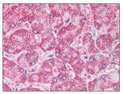Figure 1. Staining PPARG in Liver tissue by Immunohistochemistry using Formalin-Fixed Paraffin-Embedded (FFPE) tissue.