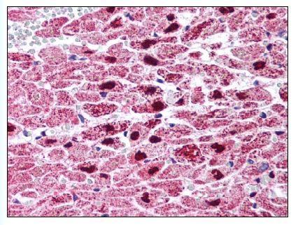 Figure 2. Staining PPARG in Heart tissue by Immunohistochemistry using Formalin-Fixed Paraffin-Embedded (FFPE) tissue.