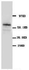 Western blot analysis of rat pancreas tissue lysis using GLAST antibody