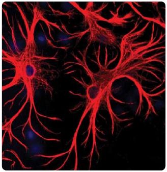 Dissociated culture of Rat cerebral cortical neurons and astrocytes (red staining). The nuclei of some neuronal cells (blue staining) are visible. Picture courtesy of Dr. Gerry Shaw, University of Florida.