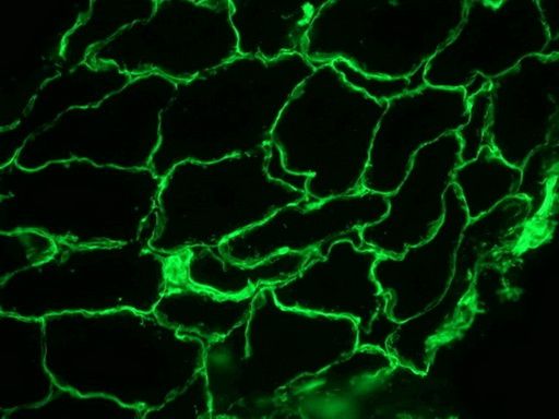 Immunofluorescence staining of Frozen Sections from Pig striated skeletal muscle (methanol fixed) using BM6046P, showing the localization of laminin in the connective tissue and in basement membranes surrounding the individual myofibers.