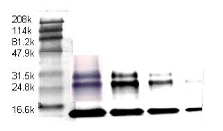 Western blot result of the antibody used at 2ug/mL to detect platelet derived TGF-β at 12ug/lane (lane 2) 6ug/lane (lane 3), 3 ug/lane (lane 4) and 1ug/mL (lane 5) with 4- chlorol-napthol as substrate. The bottom band is the 12.5KD TGF-β monomer, the mid-band is the 25KD TGF-β dimer and the up band is TGF-β with signal peptide. Lane 1 is molecular weight markers.