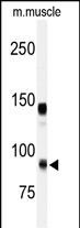 Western blot analysis of anti-ADAMTS5 Antibody (Center) (Cat.#AP14095PU-N) in mouse muscle tissue lysates (35ug/lane). ADAMTS5(arrow) was detected using the purified Pab.
