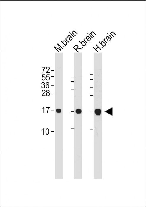 All lanes : Anti-MAP1LC3A Antibody at  dilution
Lane 1: Mouse brain whole cell lysate
Lane 2: Rat brain whole cell lysate
Lane 3: Human brain whole cell lysate

Lysates/proteins at 20 µg per lane. 

Secondary
Goat Anti-mouse IgG,  (H+L), Peroxidase conjugated at 1/10000 dilution. 

Predicted band size : 14 kDa

Blocking/Dilution buffer: 5% NFDM/TBST.