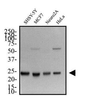 Western Blot: HMGB1/HMG-1 Antibody TA301448 - Total protein from SHSY-5Y, MCF7, Neuro2A and HeLa was separated on a 12% gel by SDS-PAGE, transferred to PVDF membrane and blocked in 5% non-fat milk in TBST. The membrane was probed with 2.0 ug/mL anti-HMGB1 in 1% non-fat milk in TBST and detected with an anti-rabbit HRP secondary antibody using chemiluminescence.