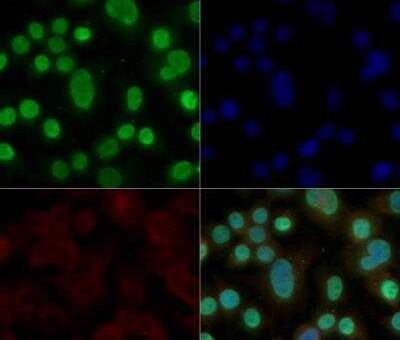 Immunocytochemistry/Immunofluorescence: HMGB1/HMG-1 Antibody TA301448 - Neuro2a cells were fixed for 10 minutes using 10% formalin and then permeabilized for 5 minutes using 1X TBS + 0.5% Triton-X100. The cells were incubated with anti-HMGB1 at 5 ug/ml overnight at 4C and detected with an anti-rabbit Dylight 488 (Green) at a 1:500 dilution. Alpha tubulin (DM1A) NB100-690 was used as a co-stain at a 1:1000 dilution and detected with an anti-mouse Dylight 550 (Red) at a 1:500 dilution. Nuclei were counterstained with DAPI (Blue). Cells were imaged using a 40X objective.