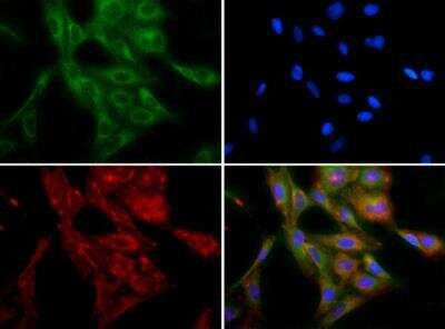 Immunocytochemistry/Immunofluorescence: beta-1,3-Glucuronyltransferase 1/B3GAT1 Antibody TA309582 - Antibody was tested in U2OS cells with FITC (green). Nuclei and alpha-tubulin were counterstained with DAPI (blue) and Dylight 550 (red).